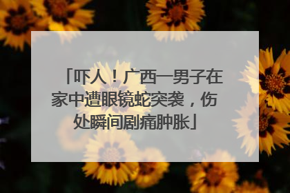 吓人！广西一男子在家中遭眼镜蛇突袭，伤处瞬间剧痛肿胀